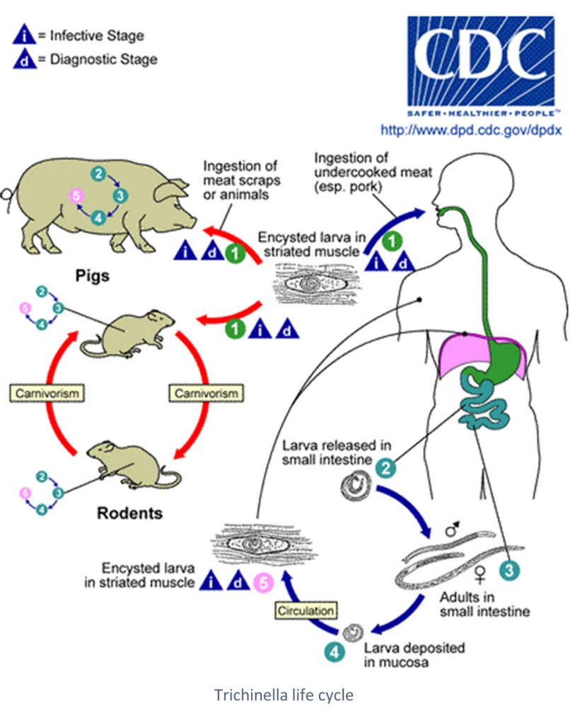 LDBIO_Contexte-clinique_TRICHINELLOSIS_EN