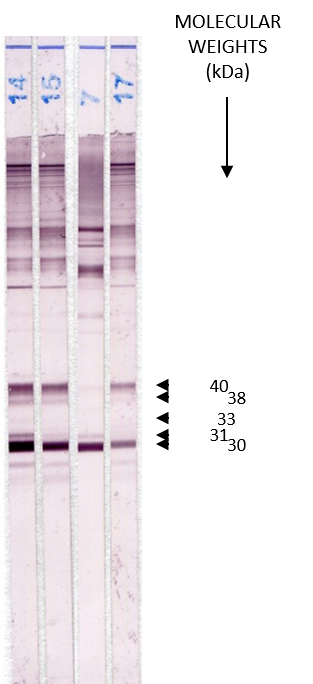 LDBIO TOXO II IgM 